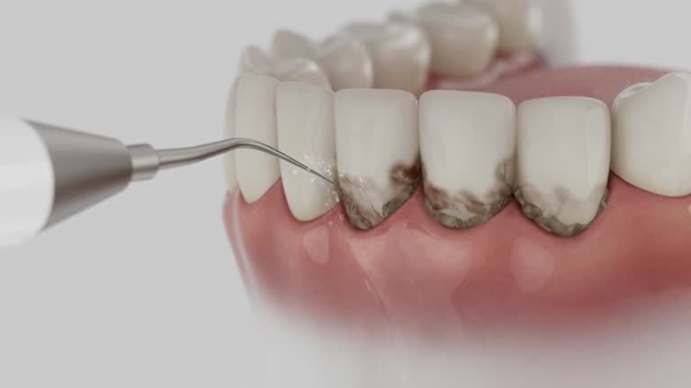 Reliable Dental Implants contractor in Barneveld, WI by Smile Center Dentistry